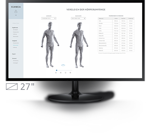 SCANECA software showing before/after body comparison at Bluezone Mallorca